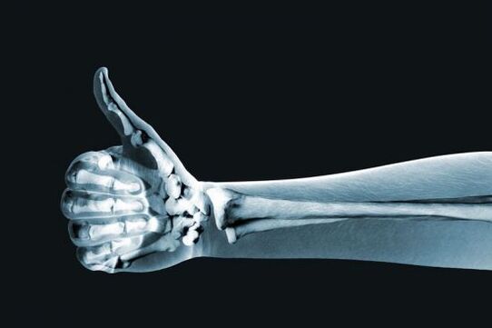 X-zraka može pomoći u dijagnosticiranju bolova u zglobovima prstiju