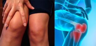 Nelagoda i oteklina u području koljena prvi su simptomi artroze